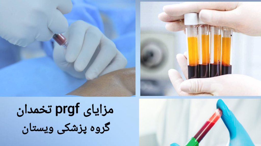 تزریق prgf توسط پزشک پزشک برای بیمار تزریق prgf انجام می دهد.
