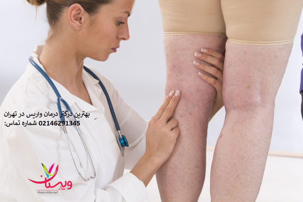 بهترین دکتر واریس در تهران