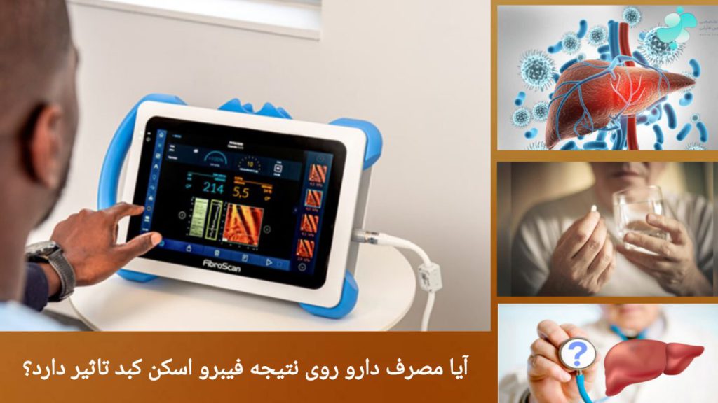 خوردن دارو قبل از انجام فیبرو اسکن کبد بررسی نتیجه فیبرو اسکن بیمار و خوردن دارو قبل از فیبرو اسکن کبد