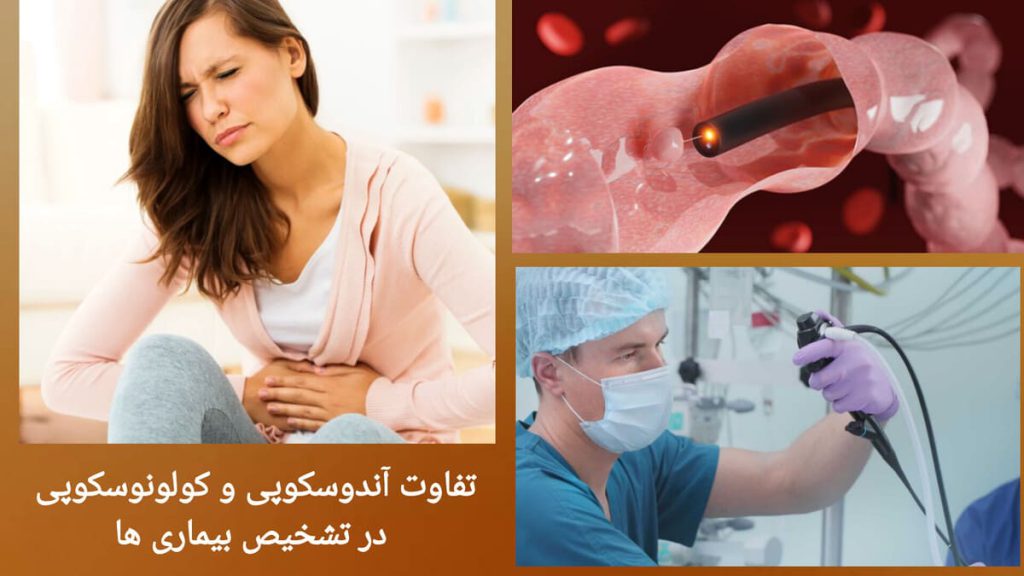پزشک در حال تشخیص بیماری های دستگاه گوارش با آندوسکوپی و کولونوسکوپی