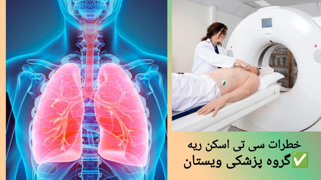 خطرات احتمالی انجام سی تی اسکن ریه نمایی از ریه بیمار و خطراتی که سی تی اسکن برای بیمار ایجاد می کند.
