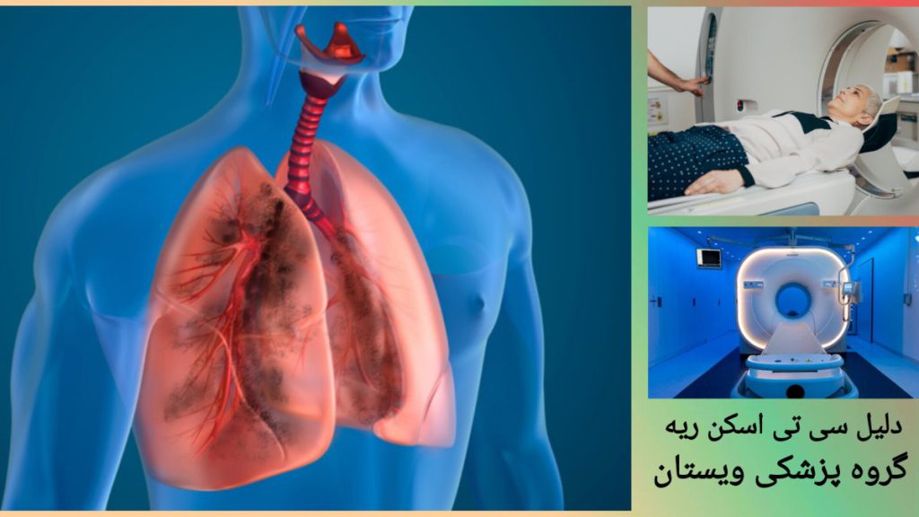 مشکل ریوی در بیمار و نمایی از دستگاه سی تی اسکن نمایی از بیمار که مشکل ریوی دارو و دستگاه سی تی اسکن