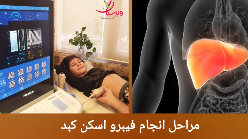 فیبرو اسکن کبد برای یک کودک انجام فیبرواسکن کبد برای کودکی که لبخند می زند