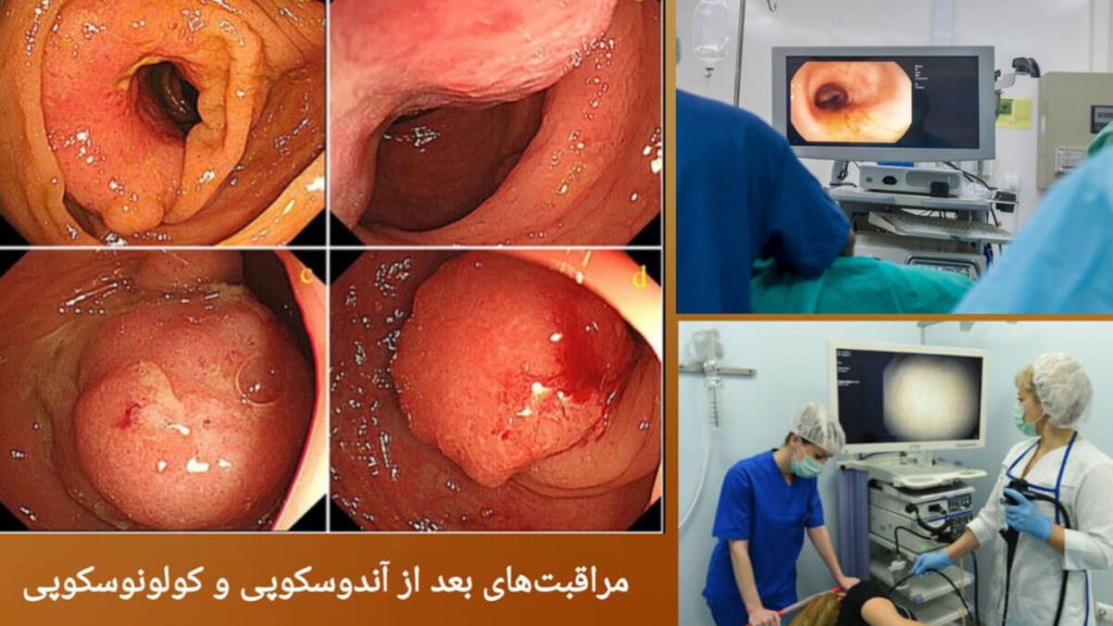 نمایی از انجام کولونوسکوپی و آندوسکوپی توسط پزشک