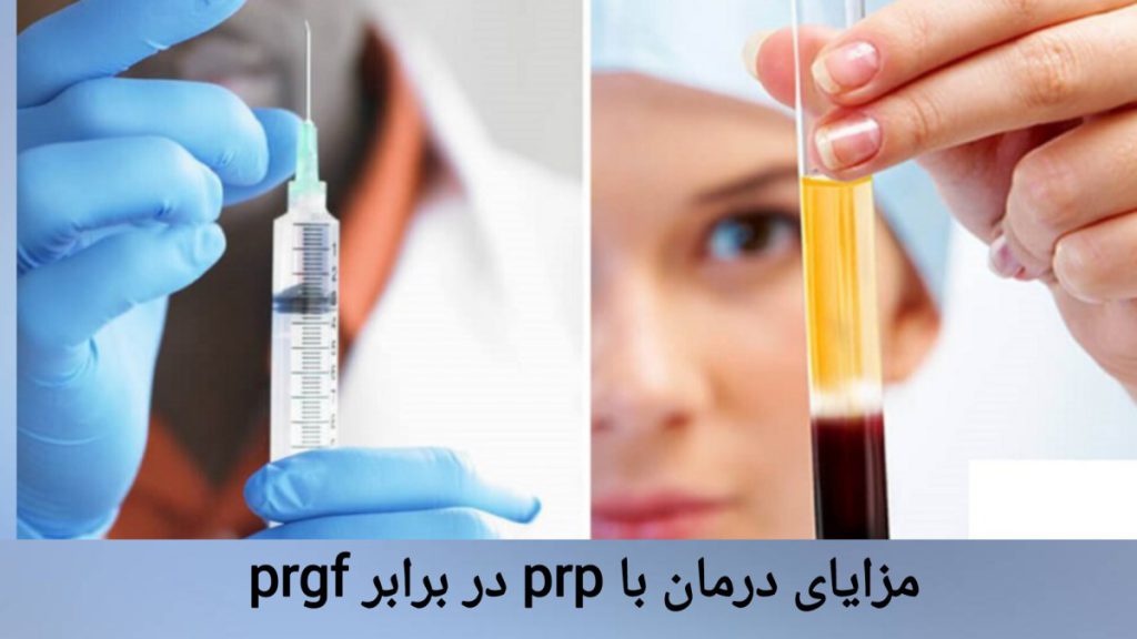 نمونه ای از پی آر پی در دست پزشک پزشک نمونه ای از پی آر پی را در دست دارد