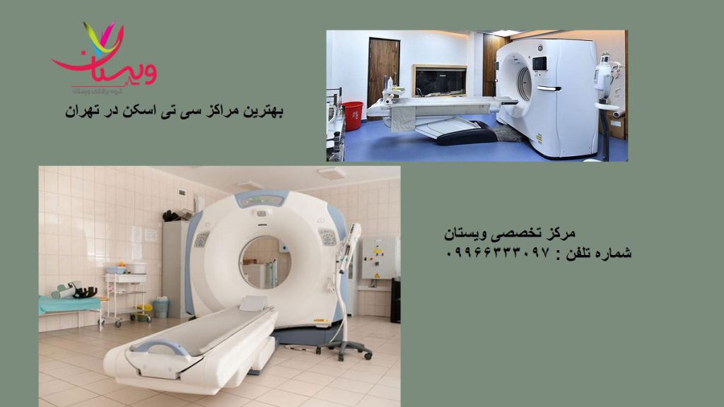 بهترین مرکز سی تی اسکن تهران