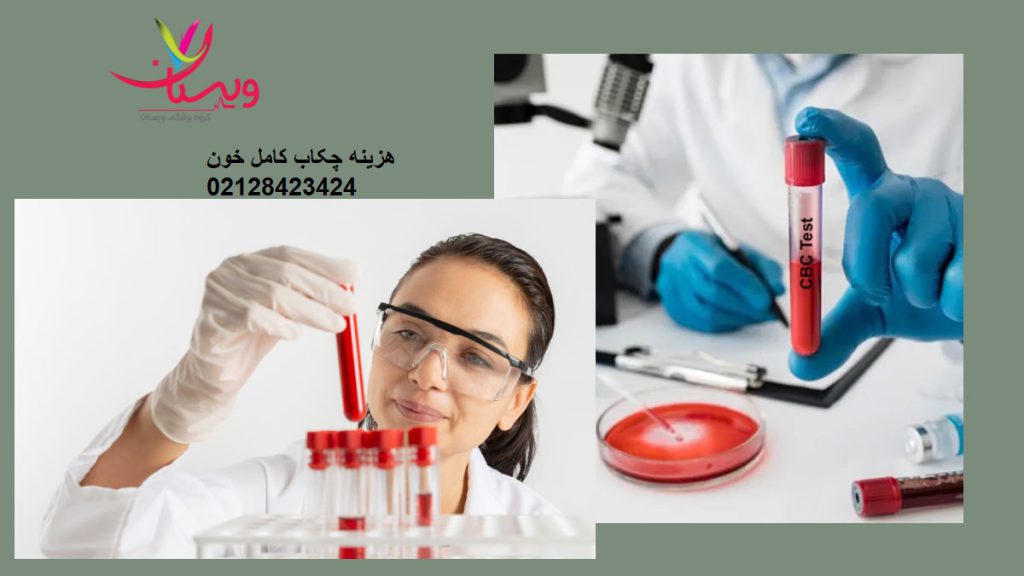 هزینه چکاب کامل