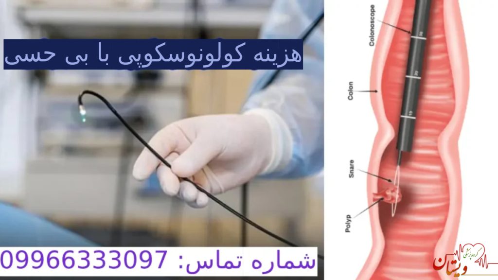 هزینه کولونوسکوپی بدون بیهوشی - با بی حسی موضعی -