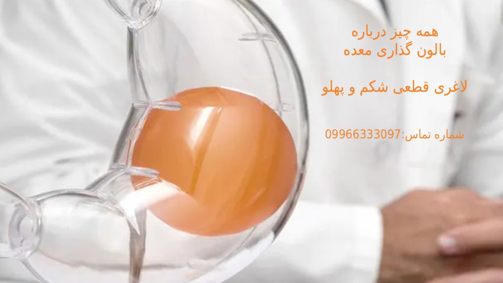 لاغری شکم و پهلو تصویر ماکت بالن درون معده با شماره مشاوره رایگان 24 ساعته کلینیک ویستان