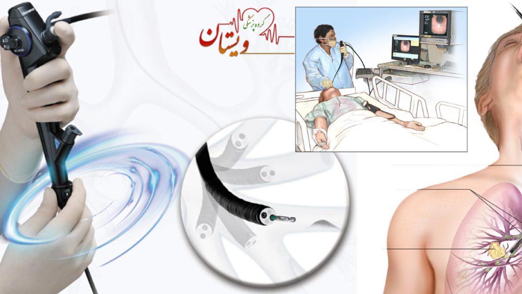 برونکوسکوپی ریه عکس برونکوسکوپ تصویری از پزشک در حال انجام برونکوسکوپی و مشاهده وضهیت ریه بیمار در مانیتور