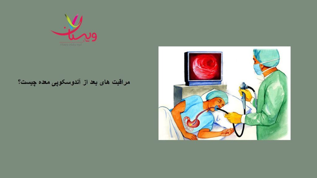 مراقبت های بعد از آندوسکوپی مهده