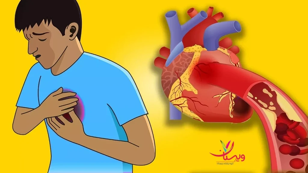درمان آنژین قلب در کودکان درمان آنژین قلب در کودکان