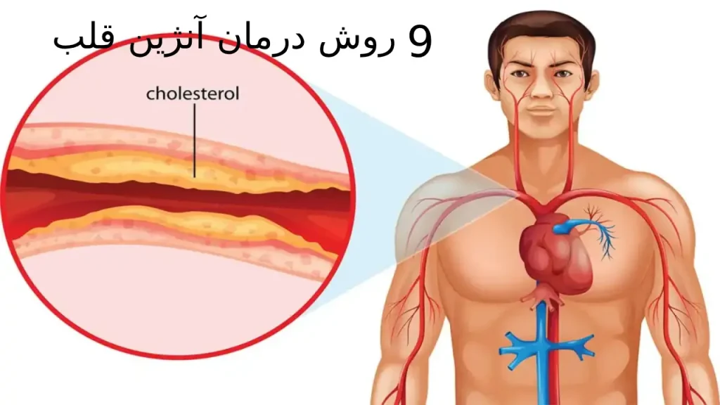 درمان آنژین قلب | + 9روش مهم