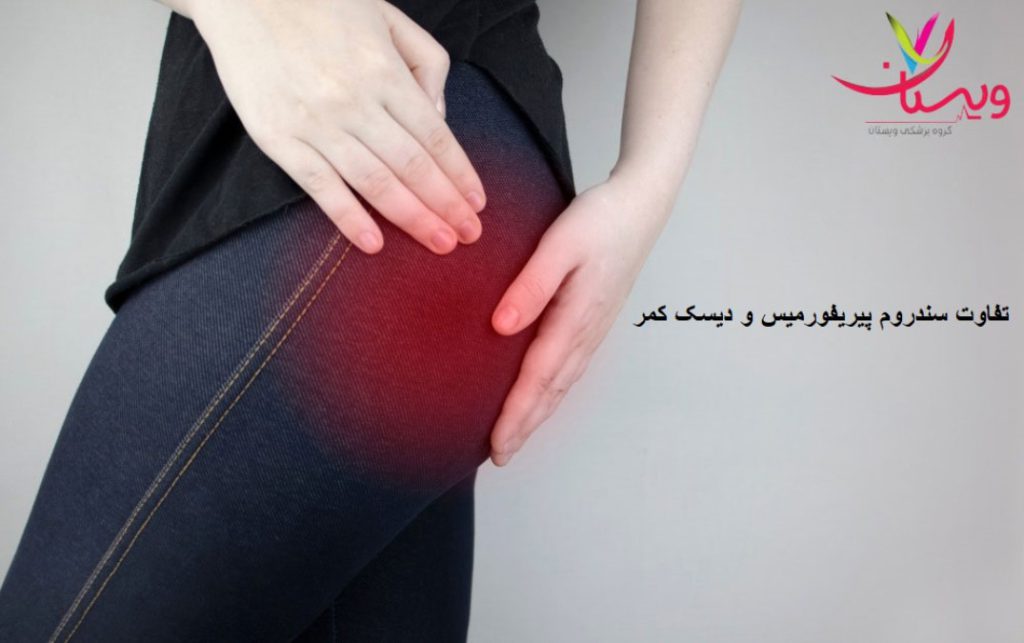 فرق بین سندروم پیریفورمیس و دیسک کمر