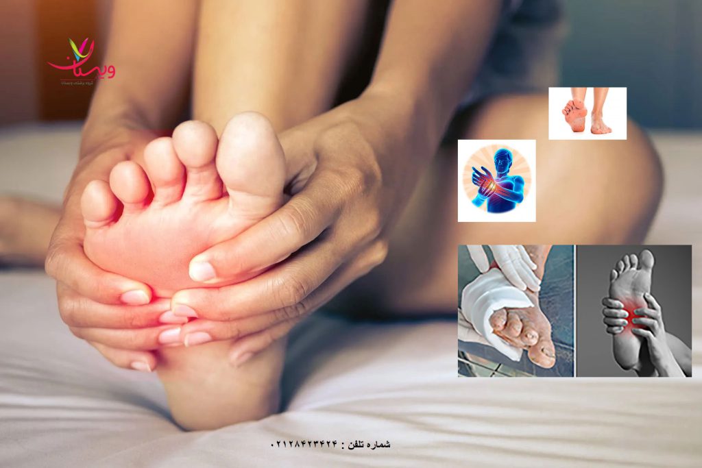 نوروپاتی دیابتی