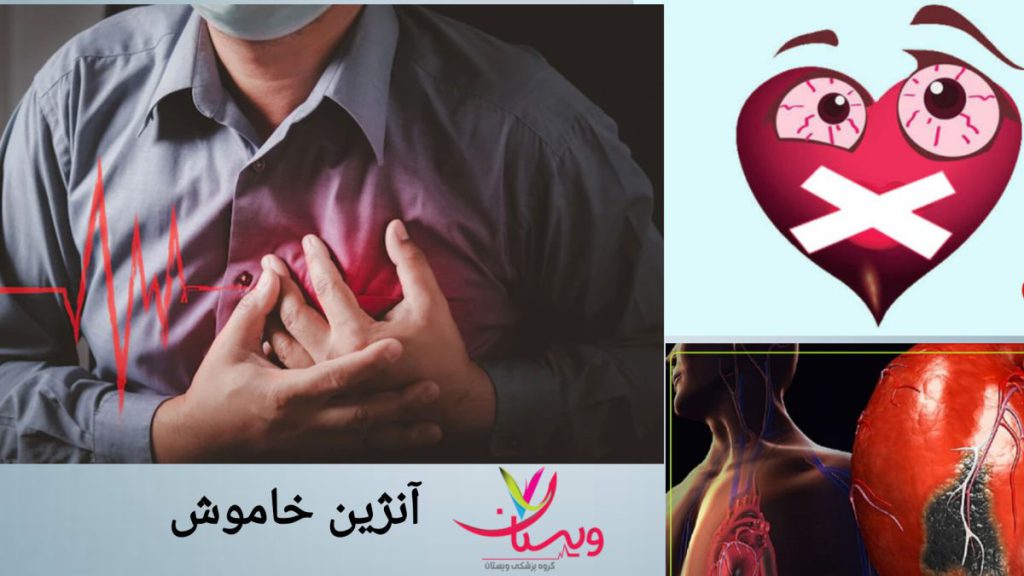 خطرات جدی در آنژین خاموش شناخت خطرات آنژین خاموش قلبی