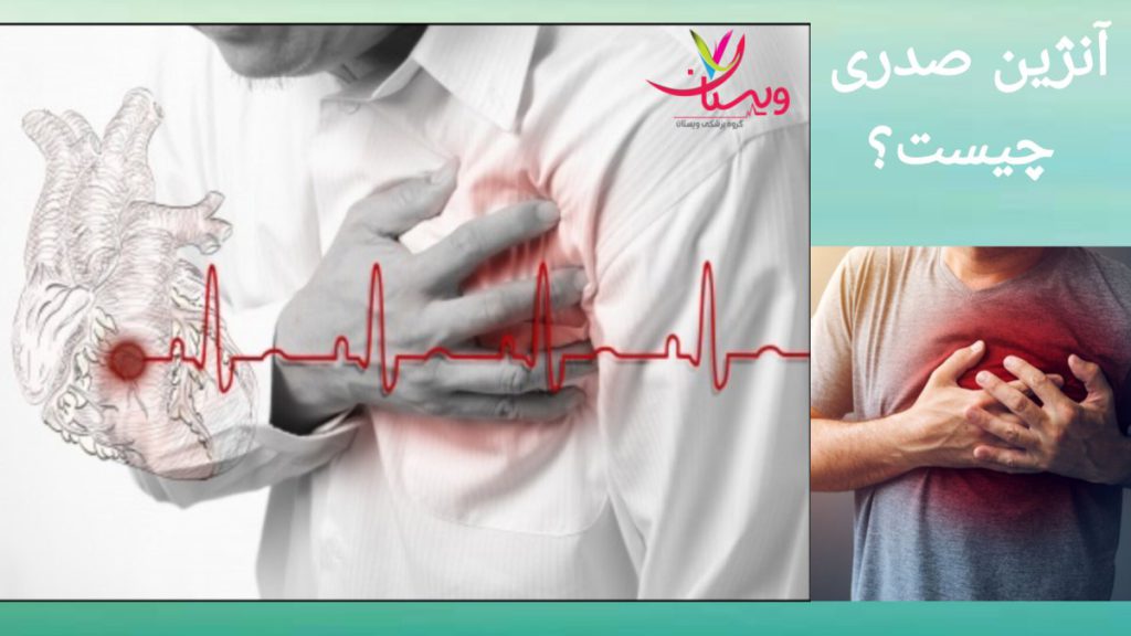 نوار قلب برای تشخیص آنژین صدری نمایی ازتشخیص آنژین صدری در نوار قلب بیمار