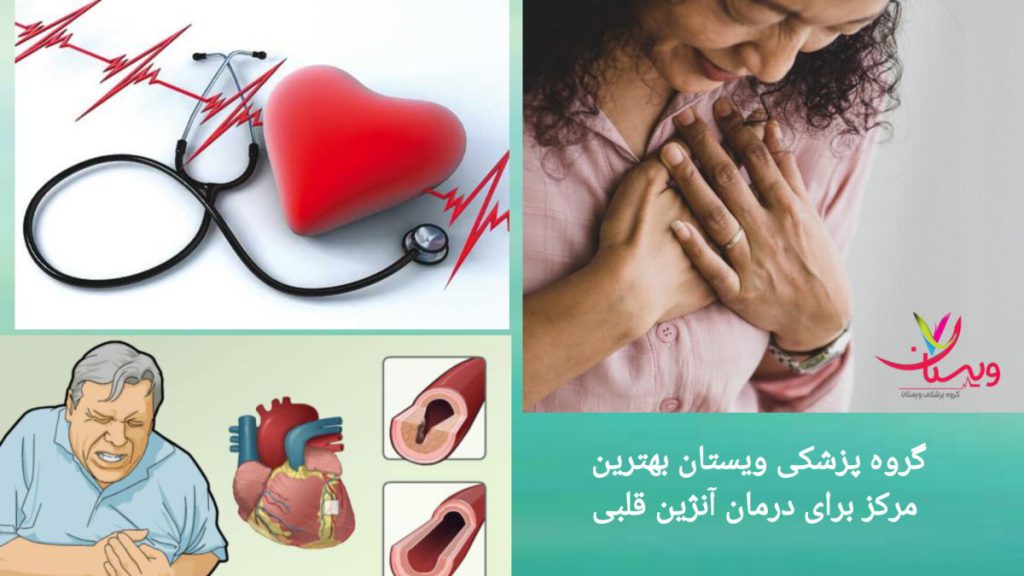 گروه پزشکی ویستان بهترین مرکز درمان آنژین قلب درمان آنژین قلب در بهترین مرکز تخصصی