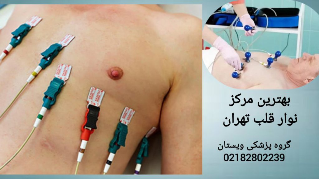 انجام نوار قلب برای بیمار در کلینیک تخصصی ویستان