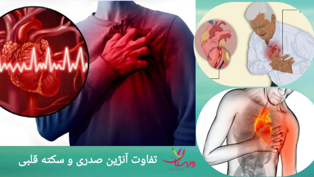 تفاوت های آنژین قلبی و سکته قلبی تفاوت در فردی که دچار سکته قلبی شده و فردی که آنژین صدری دارد.