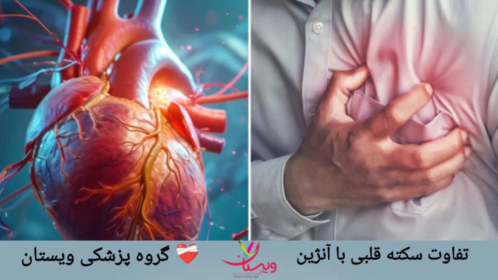 تفاوت سکته قلبی با آنژین در علائم و تشخیص
