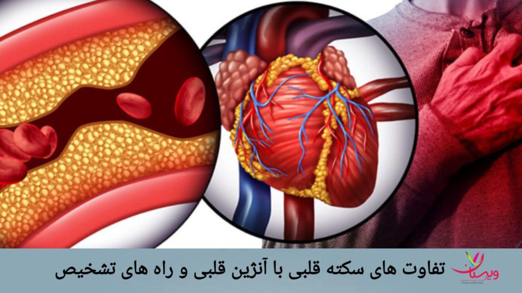 تفاوت سکته قلبی با آنژین و روش های تشخیص آن ها