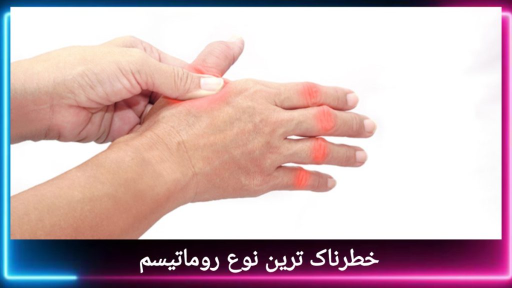 مبتلا شدن فرد به روماتیسم خطرناک بیماری که دچار روماتیسم خطرناک شده است