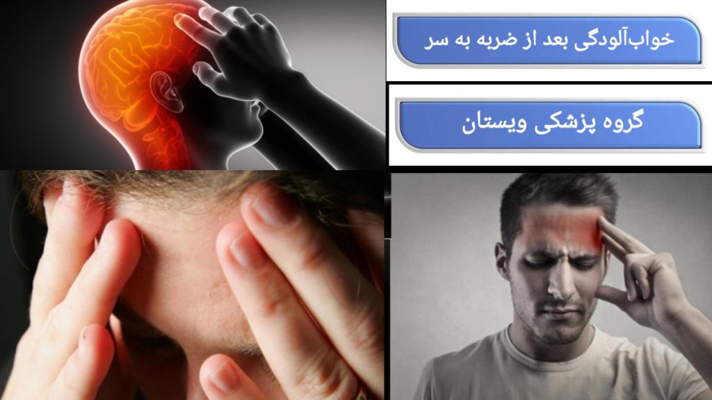 فردی به دلیل ضربه به سر، دچار خواب آلودگی شده است.