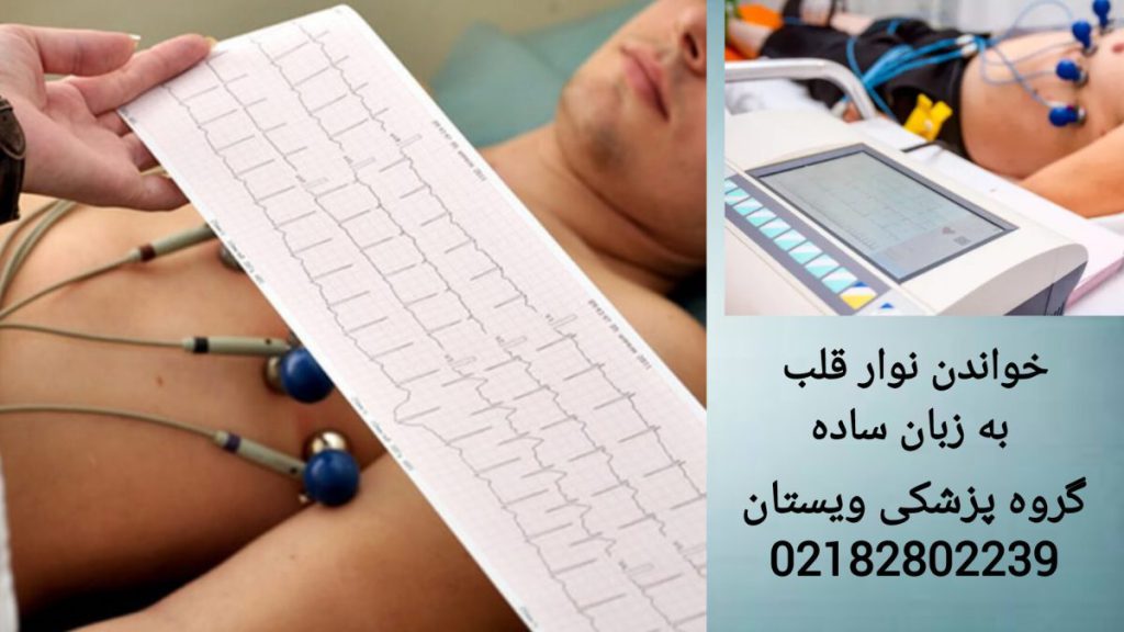 پزشک در حال خواندن جواب نوار قلب