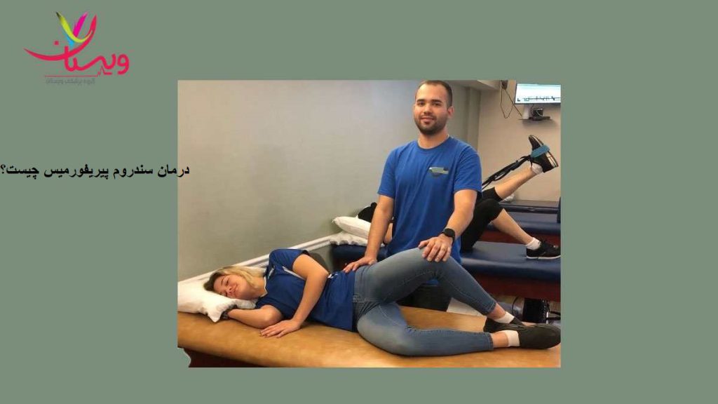 درمان سندروم پیریفورمیس
