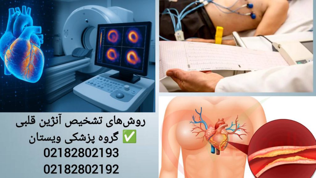 تست نوار قلب و تصویربرداری برای تشخیص بیماری قلبی