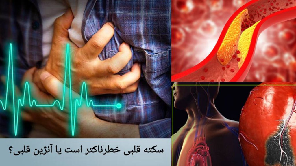 شدت خطر سکته قلبی و آنژین سکته قلبی یا آنژین، کدام جدی تر است؟