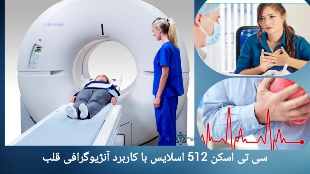 انجام سی تی آنژیوگرافی 512 اسلایس برای بیمار