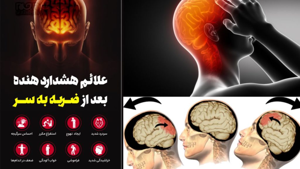 بعد از ضربه به سر چه علائمی خطرناک است