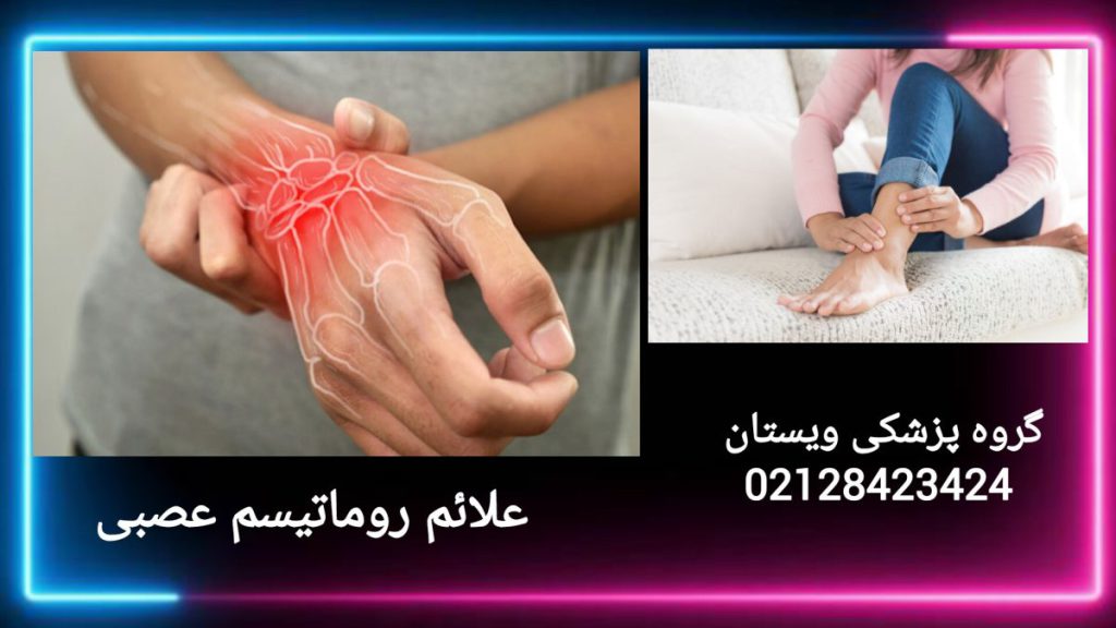 نمایی از دست بیمار با علائم روماتیسم عصبی علائم روماتیسم عصبی در بیمار