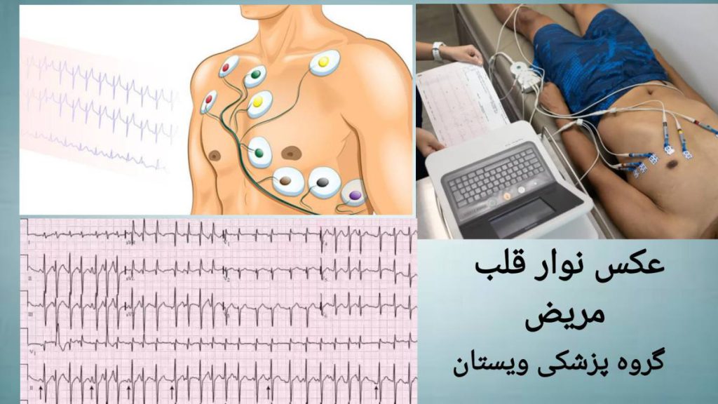 عکس نوار قلب مریض در گروه پزشکی ویستان