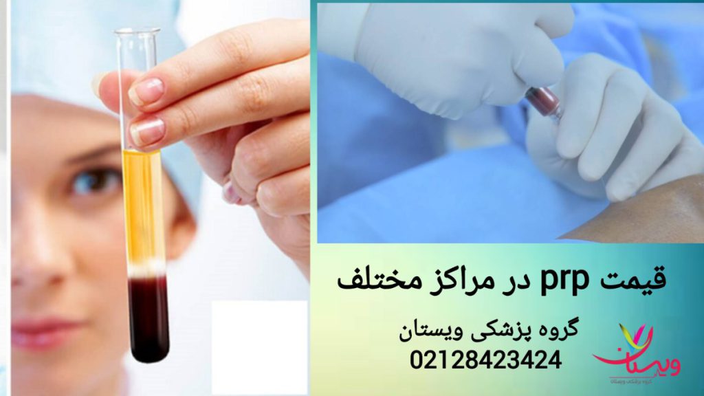 مقایسه هزینه پی آر پی زانو در مراکز مختلف نمایی از هزینه پی آر پی در مراکز مختلف تهران