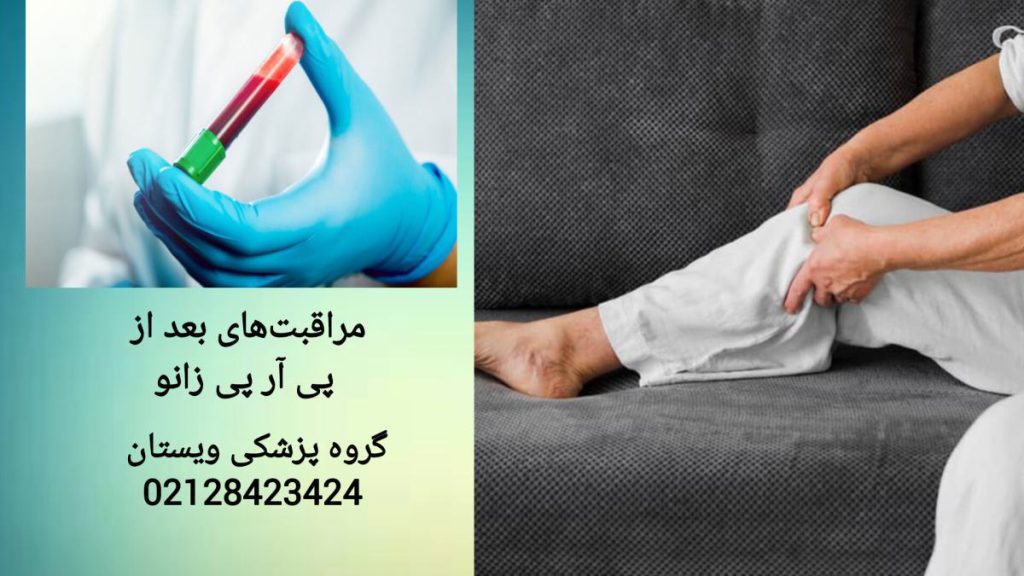 فردی که پی آر پی زانو انجام داده است و استراحت می کند.