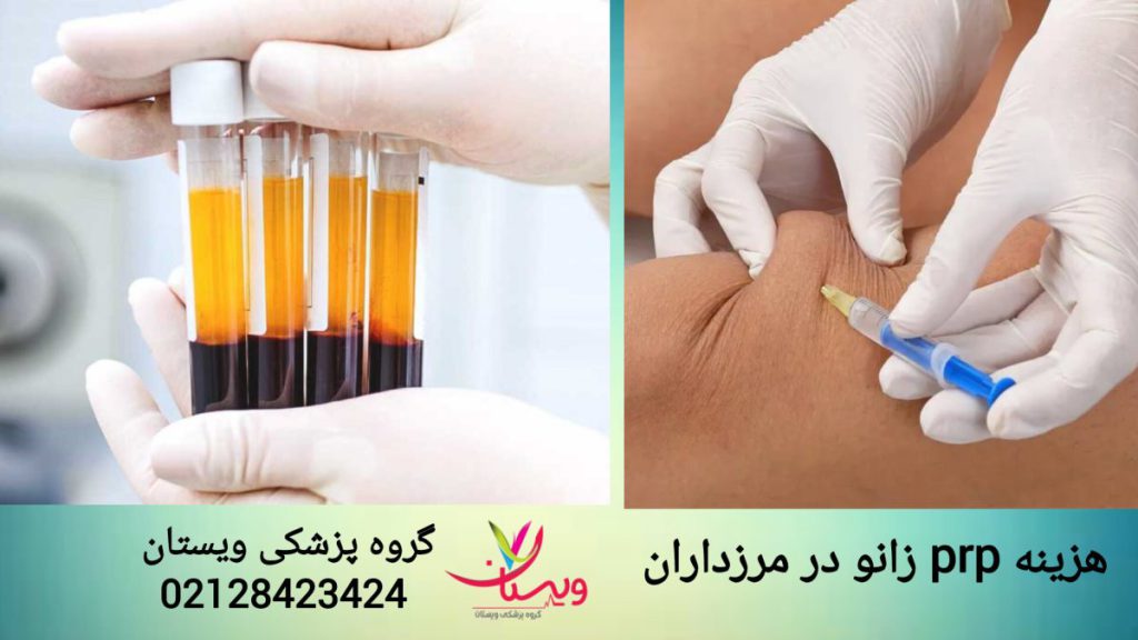 هزینه پی آر پی زانو در گروه پزشکی ویستان پزشک متخصص در گروه پزشکی ویستان، برای بیمار پی آر پی زانو انجام می دهد.