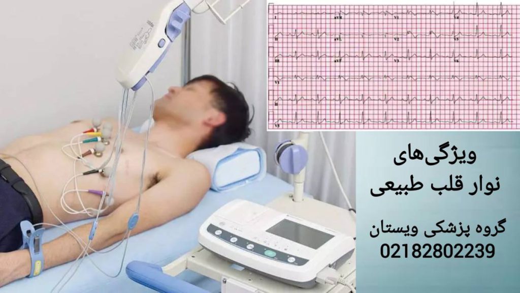 نوار قلب طبیعی