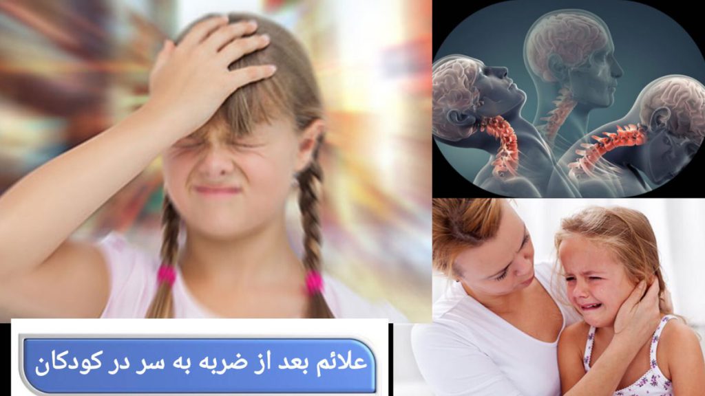 وارد شدن ظربه به سر کودک کودکی که دچار ضزبه به سر شده است.