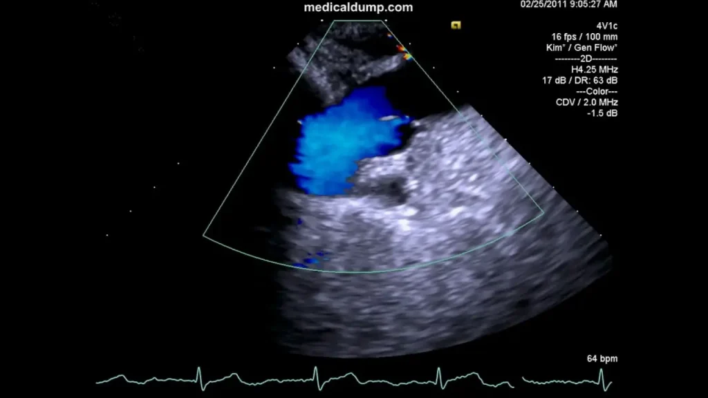 اکو قلب جنین چه کسانی باید اکو قلب جنین انجام دهند؟ (نشانگان و عوامل خطر)