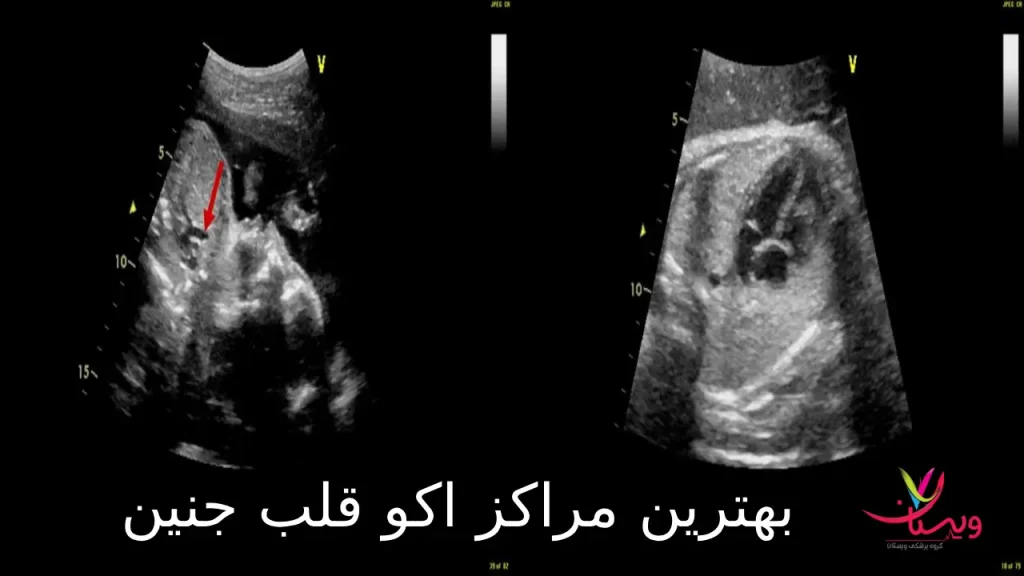 4 مورد از بهترین مراکز اکو قلب جنین