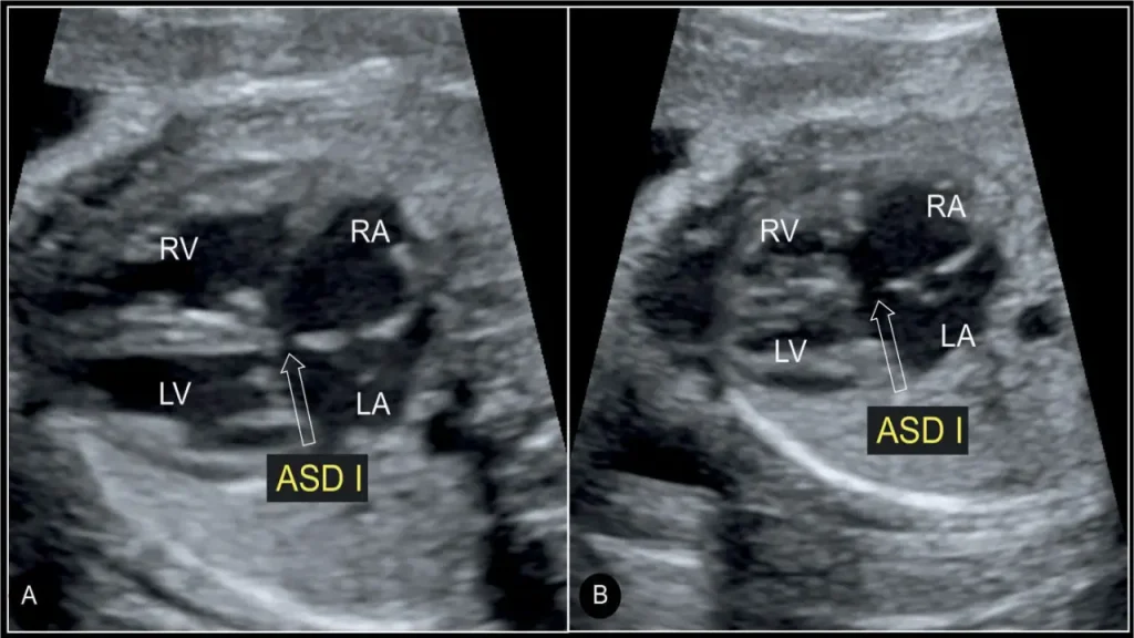 قلب جنین فهرست بهترین مراکز اکو قلب جنین