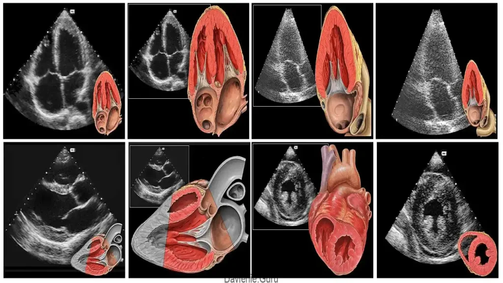 عکس اکو قلب چرا کلینیک ویستان انتخاب برتر برای اکو قلب جنین است؟ | بهترین مراکز اکو قلب جنین