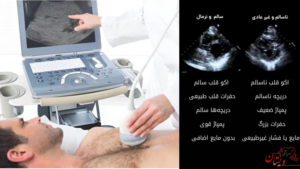 تست اکوقلب تصویری از بیمار در حال اکو قلب و مقایسه اکو قلب سالم و ناسالم در چند جمله در تصویر