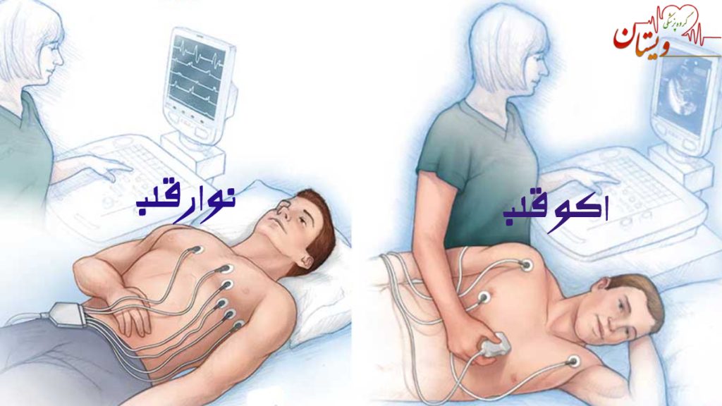 HOW DONE EKG AND ECHO تصویری از مقایسه نوار قلب و اکو قلب ، نحوه انجام توسط اپراتور پوزیشن بیمار در هرکدام