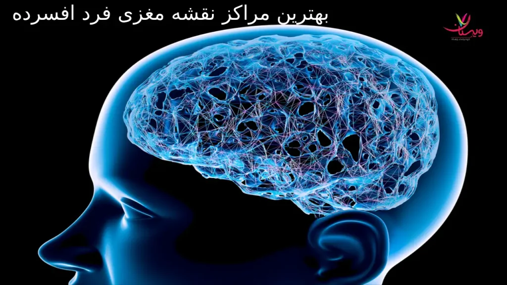 5 مورد از بهترین مراکز نقشه مغزی برای فردافسرده