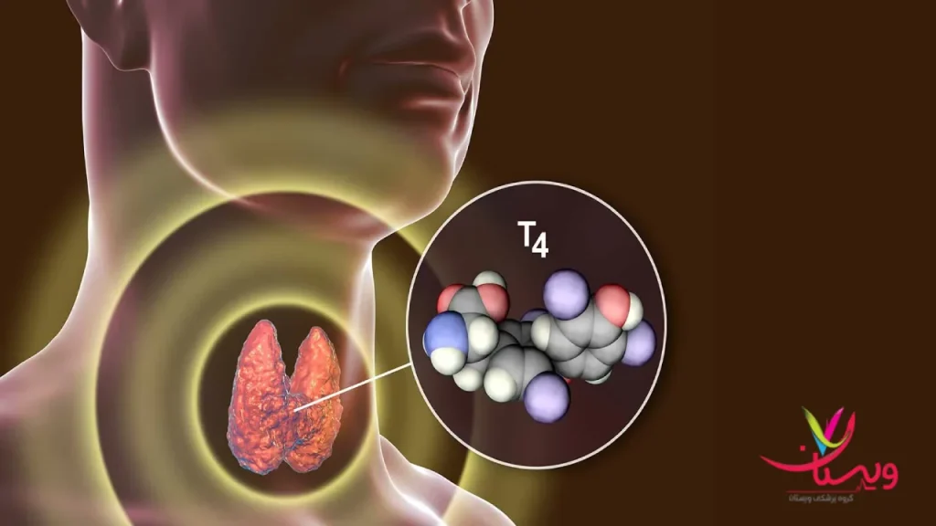 اسکن هسته ای تیروئید مشکلاتی که با اسکن هسته ای تیروئید مشخص می شوند