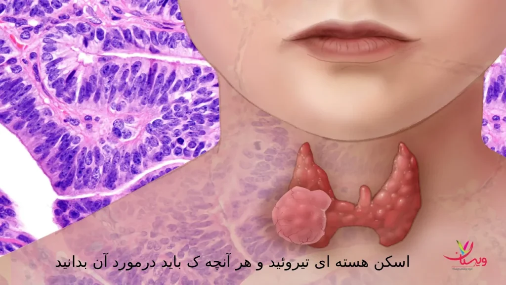 اسکن هسته ای تیروئید